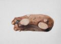 Fatty Liver Disease: Types, Symptoms, and Risk Factors