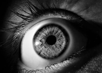 Glaucoma: Definition, Symptoms, and Causes 