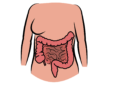 Diverticulitis: Process, Symptoms, Causes, and Complications