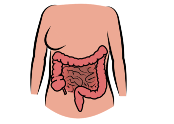 Diverticulitis: Process, Symptoms, Causes, and Complications 