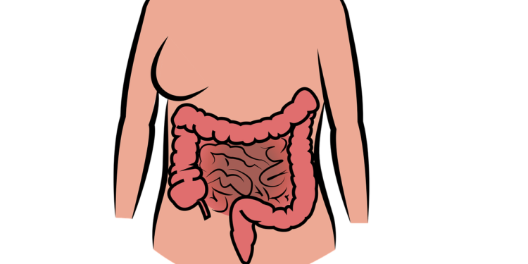 Diverticulitis: Process, Symptoms, Causes, and Complications