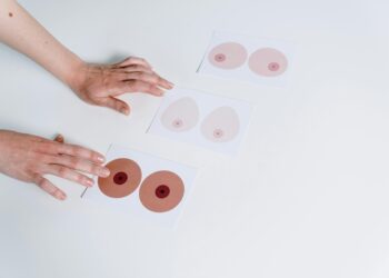 Not All Breast Pain is Breast Cancer, It Could Be Mastalgia 