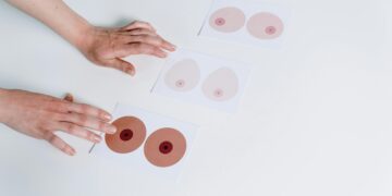 Not All Breast Pain is Breast Cancer, It Could Be Mastalgia 