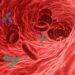 Aneurysm: Types, Symptoms and Causes