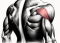 Diagnostic Procedures and Treatment of Compartment Syndrome