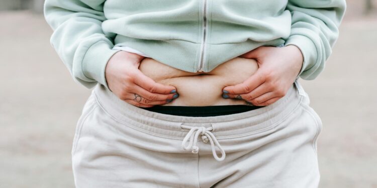 Pannus Stomach: Symptoms, Complications, and Causes