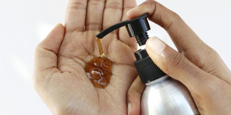 Say Goodbye to Dandruff with These Natural Hacks