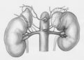 Acute Tubular Necrosis Diagnosis and Treatment