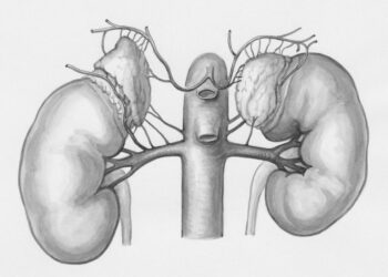 Acute Tubular Necrosis Diagnosis and Treatment 