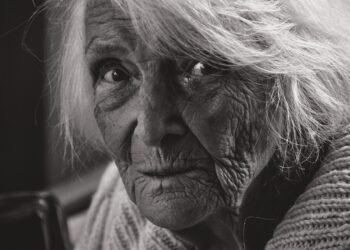 Radiesse vs Botox: Which is Better for Wrinkles?