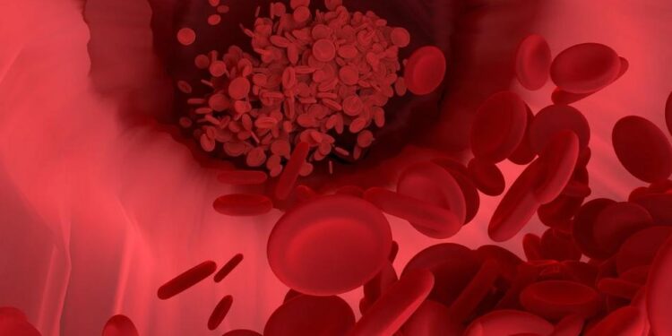 Haemophilia: Diagnosis and Treatment
