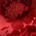 Haemophilia: Diagnosis and Treatment