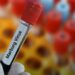 Marburg Virus Outbreak