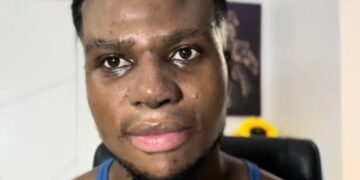 Zicsaloma Reveals Why He Underwent Nose Surgery In Turkey