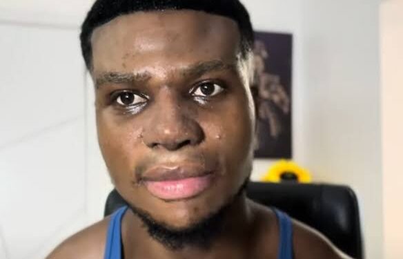 Zicsaloma Reveals Why He Underwent Nose Surgery In Turkey