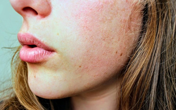 How to Unclog Pores: Dermatologist-Approved Methods for Clearer Skin