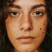 An Expert Guide to Covering a Pimple Without Making It Worse