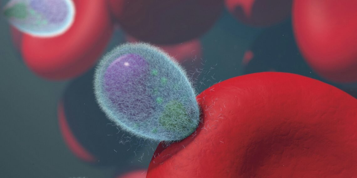 Nearly 1,000 Sick: Check These Cyclospora Outbreak Symptoms Now