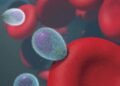Nearly 1,000 Sick: Check These Cyclospora Outbreak Symptoms Now