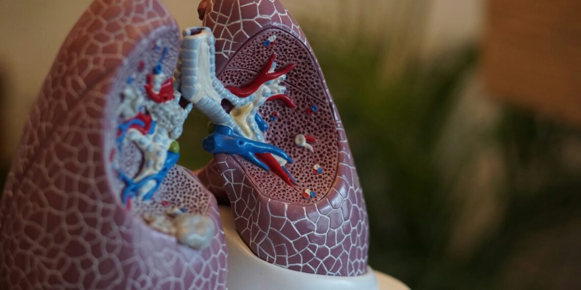 75-Year-Old Woman Reveals How Clinical Trial Helped Shrink Her Lung Cancer