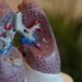 75-Year-Old Woman Reveals How Clinical Trial Helped Shrink Her Lung Cancer