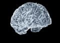 Alzheimer’s Trial To Test Experimental Drug Before Symptoms Develop